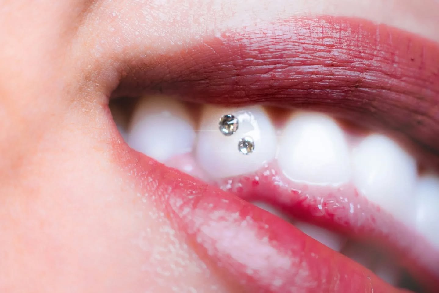 Dentalna klinika Banja Luka - moderna oprema za dentalni turizam i stomatološke usluge
